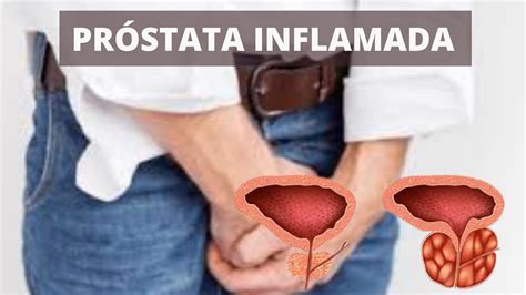 prostata inflamada - garganta inflamada e febre